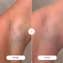 Last inn bildet i Galleri-visningsprogrammet, 1x EpiLuxe
